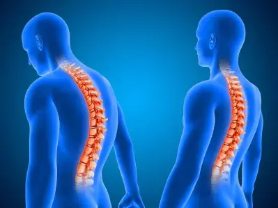 Understanding Scoliosis Surgery in Turkey: Symptoms, Causes, and Treatment Options