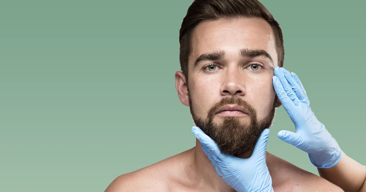 Beard Transplant