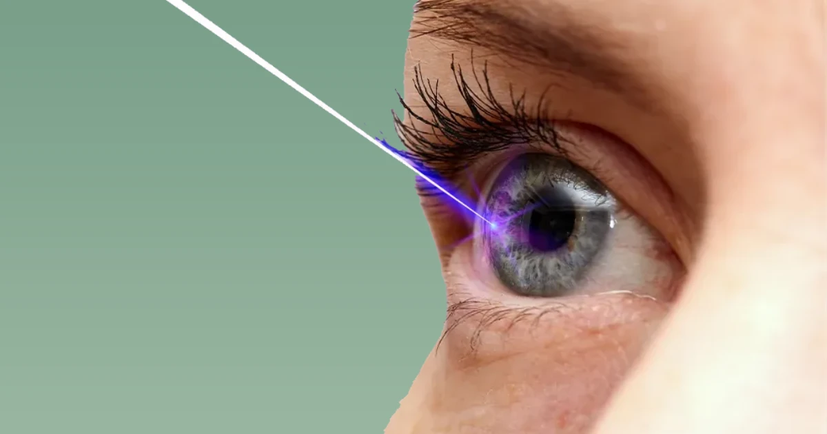 Laser Eye Surgery